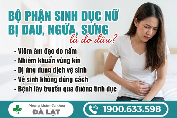 Hình ảnh minh họa